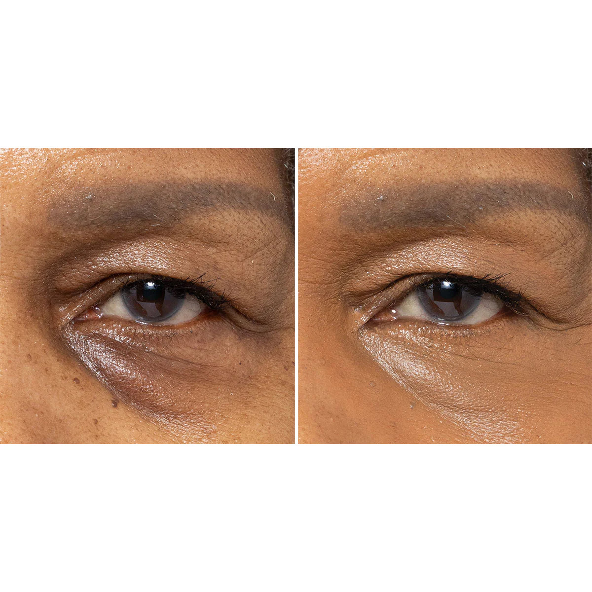 #JI Skintuition Concealer_D11